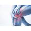 What Causes Joint Pain  ARO Motion