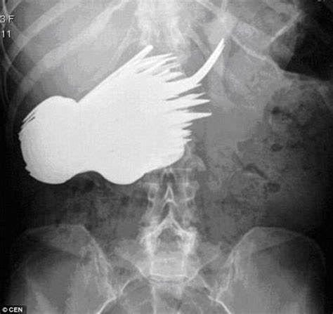 The 31 Most Ridiculous And Funny X Ray Images Youll Ever See