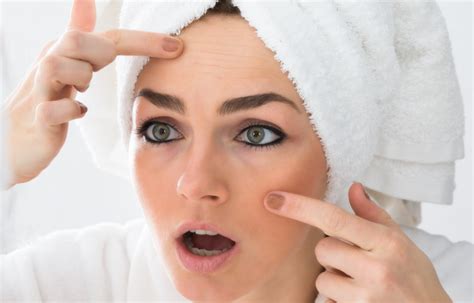 Comment soigner la peau grasse conseils et remèdes naturels Santé SOS