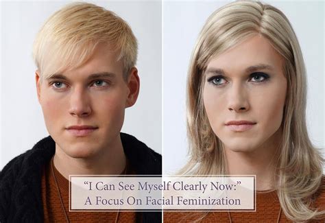 Pin On Facial Feminization Hot Sex Picture
