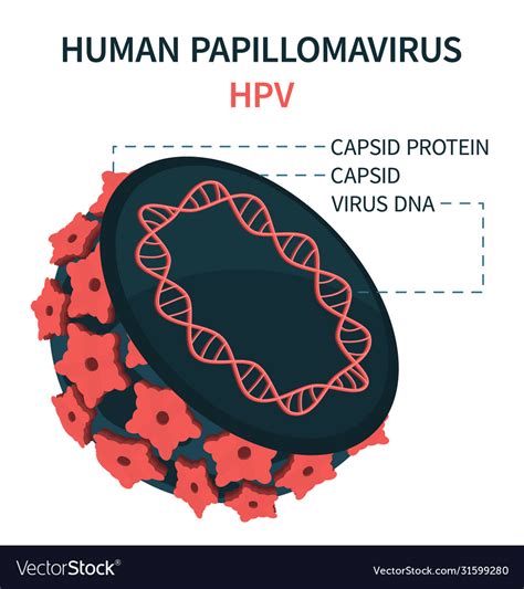 Hpv Human Papillomavirus Vector Illustration Of Viral Interior My Xxx Hot Girl