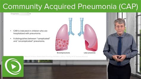 Community Acquired Pneumonia Cap Pediatrics Lecturio Youtube