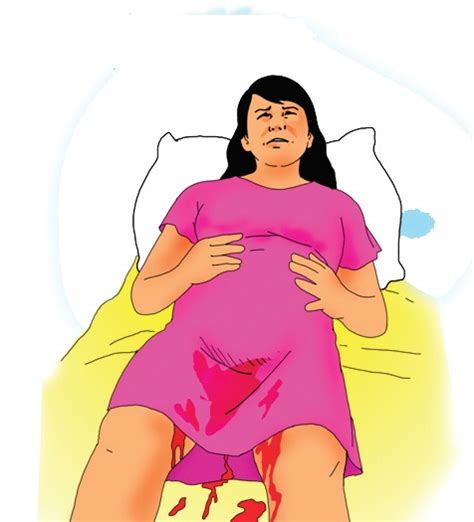 Keputihan saat hamil tua normal atau bahaya. Persiapan Ibu Melahirkan Beberapa Hal Perlu Diperhatikan ...
