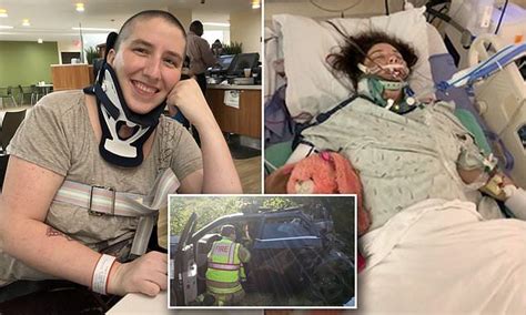 Woman Who Was Internally Decapitated After Car Crash Stuns Doctors With