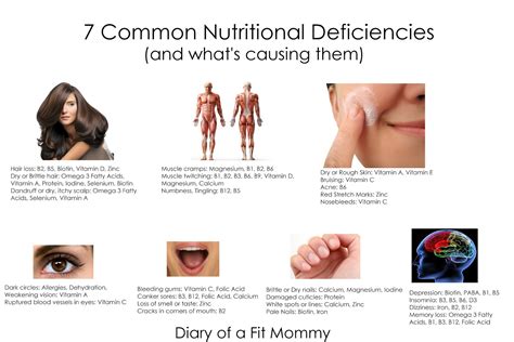 A study showed that 30% of its participants suffered from hair loss as a side effect of iodine deficiency. Diary of a Fit Mommy: 7 Common Nutritional Deficiencies ...