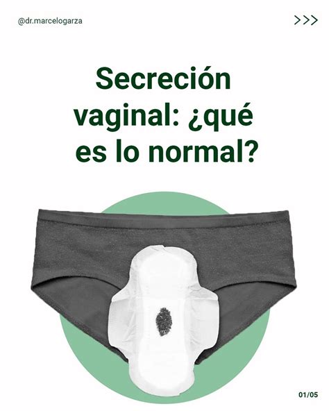 La Secreción Vaginal Es Dr Luis Marcelo Garza Ayala