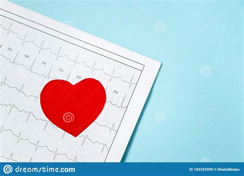 Close Up Of Ecg Cardiogram Pulse Graph On A Paper Medical Examination