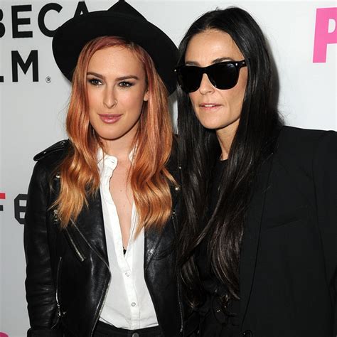 Rumer Willis Chin Before After