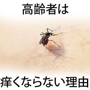 If you need a premium account, please buy it from my keep2share links. 【写真】蚊アレルギー(蚊刺過敏症)大人の症状は 熱・水ぶくれ ...