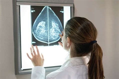 What Is A Mammogram 5 Things You May Not Know