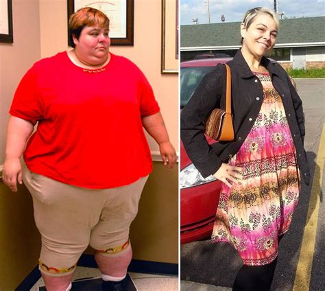 My 600 Lb Life Star James K Before And After Inside His Weight Loss