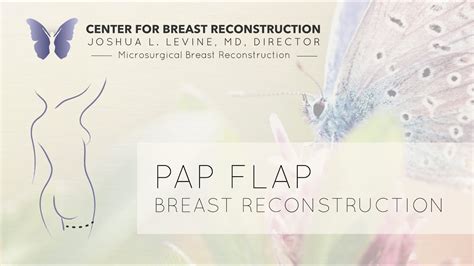 Pap Flap Breast Reconstruction Guided Illustration By Dr Joshua L