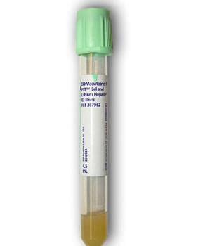 Vacutainer Plasma Separation Tube Us Labels And Materials Group