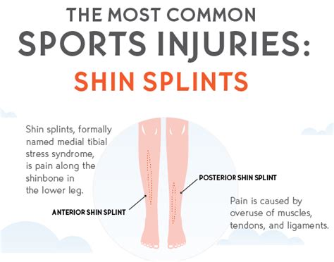 All About Shin Splints Fastmed