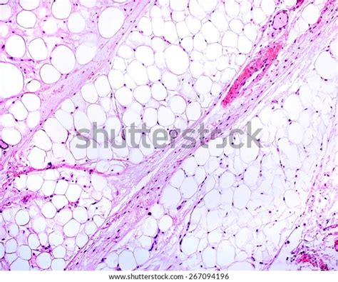 Light Micrograph Of White Adipose Tissue Adipocytes Fat Cells
