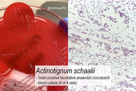 Actinotignum Schaalii On Culture And Microscopy Gram Grepmed