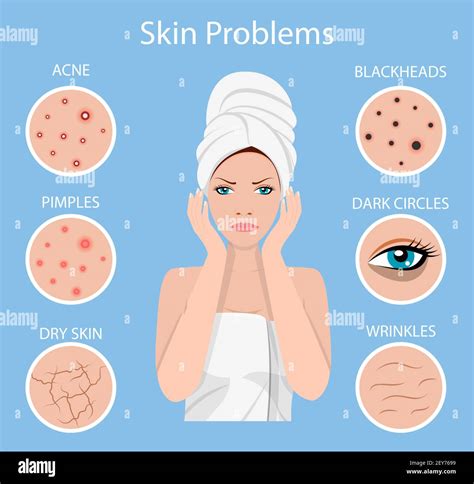 Woman Facial Skin Problems Stock Vector Image And Art Alamy