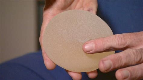 Worldwide Recall Issued For Textured Breast Implants Linked To Rare Cancer Cbc News