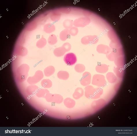 Human Blood Smear Showing Monocyte Center Stock Photo 2248572641