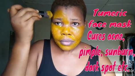 How To Use Turmeric Powder To Clear Acne Pimples Dark Spot Sunburn