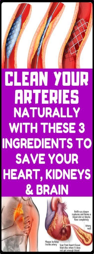 how to clean out plaque in arteries 3 ingredients mixture clean arteries arteries diy health