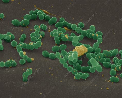 Streptococcus Mutans Bacteria Stock Image B2360117 Science Photo