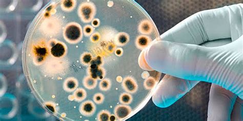 Historia De La Microbiologia Timeline Timetoast Timelines