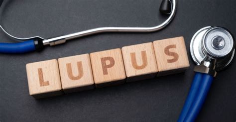 10 Signs Of Lupus Facty Health
