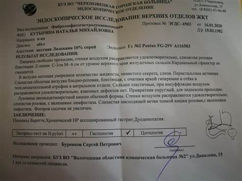 Пищевод барретта диета меню