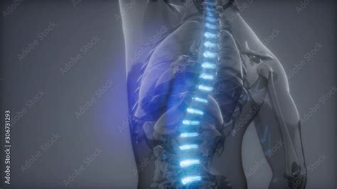 Backache In Backbone Science Anatomy Scan Of Human Spine Bones Glowing