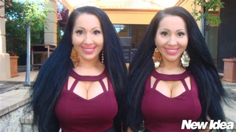 Worlds Most Identical Twins Before And After Photos New Idea Magazine