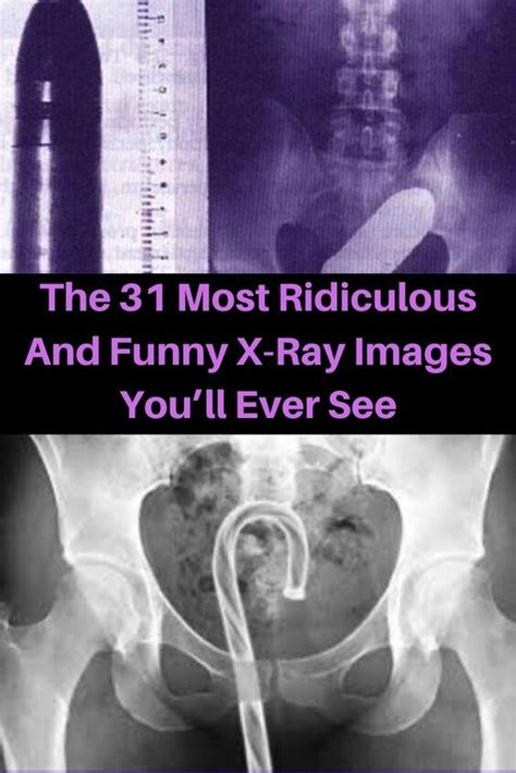 The 31 Most Ridiculous And Funny X Ray Images Youll Ever See