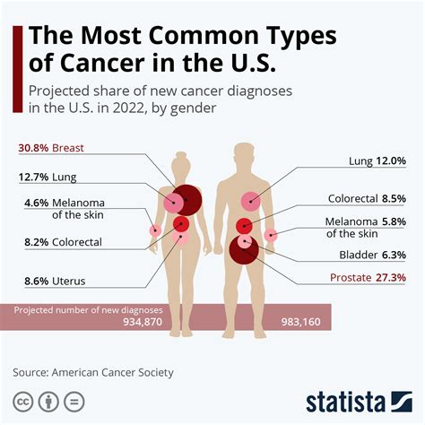 Chart The Most Common Types Of Cancer In The U S Statista