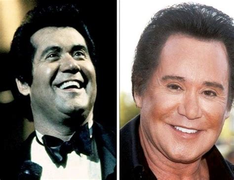 Wayne Newton Plastic Surgery Before and After Photos 2014 ...