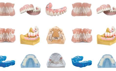 Know Your Denture Options