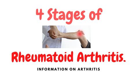 Rheumatoid Arthritis The Four Stages Of Ra Youtube