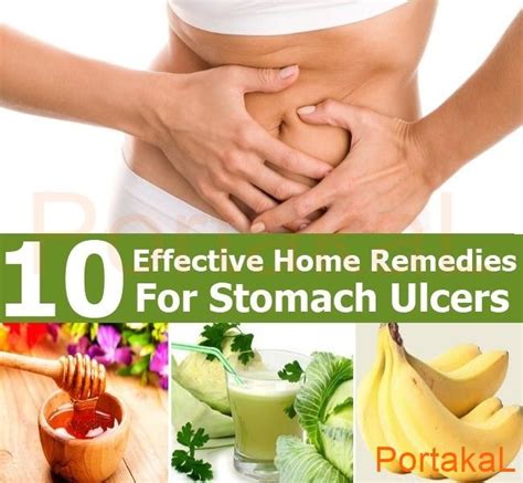 15 Natural Remedies For Common Health Issues Food For Stomach Ulcers Stomach Remedies Ulcer Diet