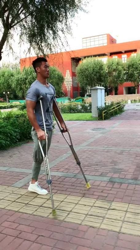 Fabulous Crutching Above Knee Amputee Men — Gorgeous Asian Crutching