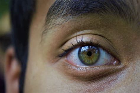 Rare Eye Colors In Humans