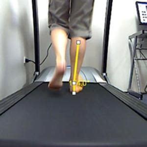 Gait Analysis And Foot Orthotics Cherie Viljoen Podiatrist