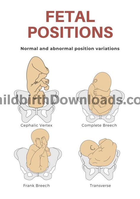 Fetal Positions Digital Poster Available To Download And Print Ideal Hand Out For Birth Workers