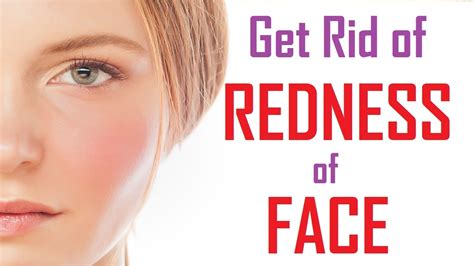 Top 15 Ways To Reduce Face Redness How To Get Rid Of Redness On Face