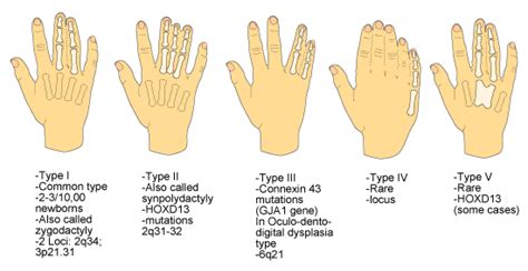 Hand Malformations Division Of Genetics And Metabolism College Of