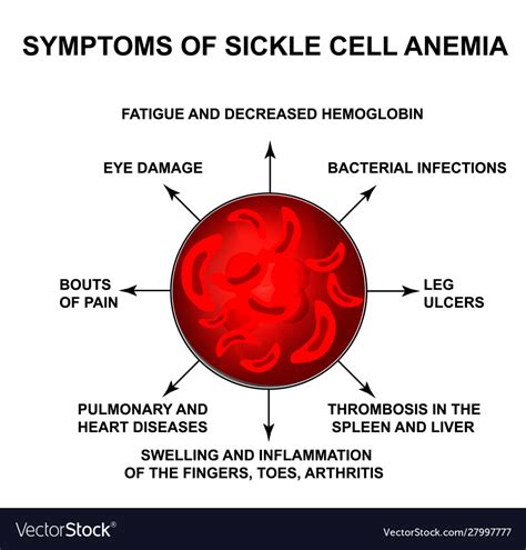 Symptoms Sickle Cell Anemia World Sickle Cell Vector Image