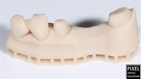 3d Printed Dental Model Per Arch Pixel Dental Lab Singapore