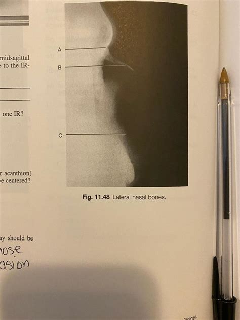 Rt Lateral Nasal Bone Radiograph Label Diagram Quizlet Hot Sex Picture