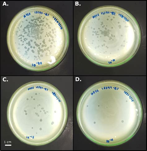 E Coli Confluent Lawn From Double Layer Agar Plates Plates Inoculated