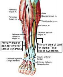 The muscles and flesh along the edge of the shin bone become inflamed, so it hurts to walk, run, or jump. BlueHost.com | Tibial stress syndrome, Shin splints ...