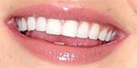 gigi hadid teeth pictures