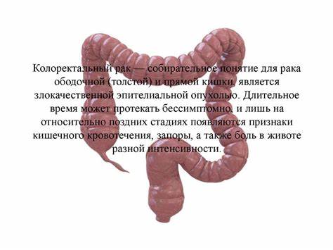 Диета колоректальный рак